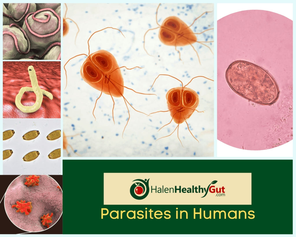 Parasites in Humans 1024x819 - Parasite Cleanse Diet for humans: 21 best natural remedies!